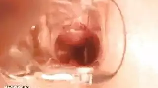 مص بطيء وثابت استخراج سائله