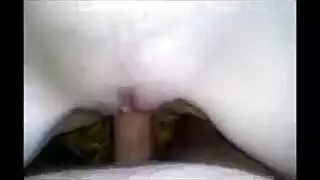 حليب الترويل الثدي